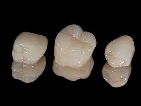 Three dental crowns sitting in a row
