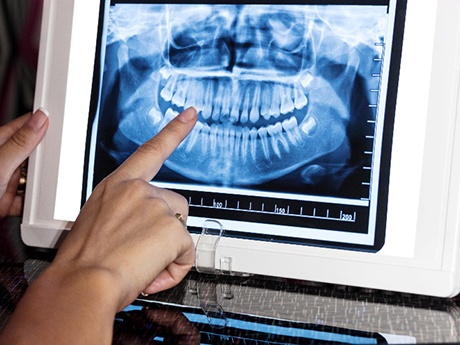 Dentist looking at patient's dental X-ray