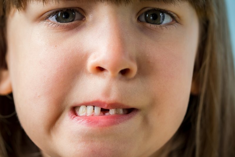 A worried little girl with a knocked-out tooth